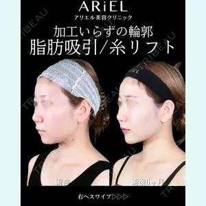 アリエル美容クリニック 大宮院 鈴木　桂介医師の症例