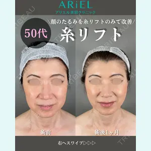 アリエル美容クリニック 大宮院 鈴木　桂介医師の症例