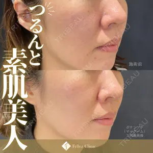 Fellez Clinic【フェルズクリニック】の症例