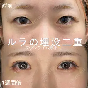 ルラ美容クリニック 仙台院 橋本 英樹医師の症例