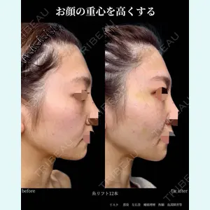 グローバルビューティークリニック 大阪院の症例