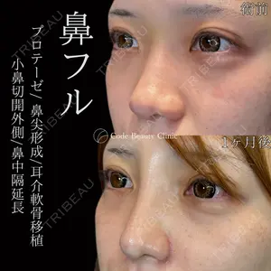 Code Beauty Clinic 名古屋院 橋本 祥平医師の症例
