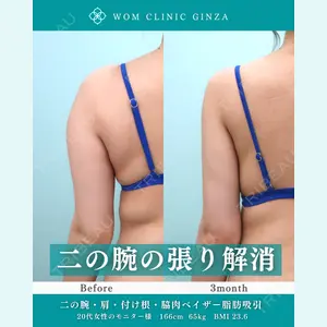 症例