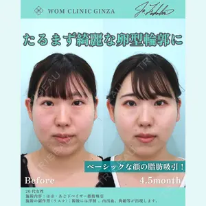 WOM CLINIC GINZA （ワム クリニック ギンザ） 深堀 純也医師の症例