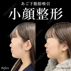東京シンデレラ美容外科 新宿院 土門 一迅医師の症例