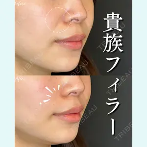 ルラ美容クリニック 大宮院 右京 大季医師の症例