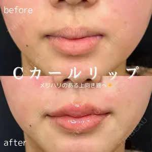 ルラ美容クリニック 仙台院の症例