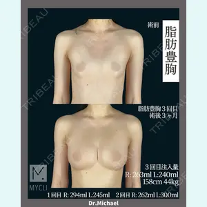MYCLI【マイクリ】東京・恵比寿院 本田マイケル武史医師の症例