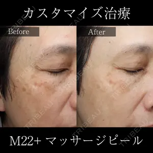 麹町皮ふ科・形成外科クリニック 安藤 玲奈医師の症例