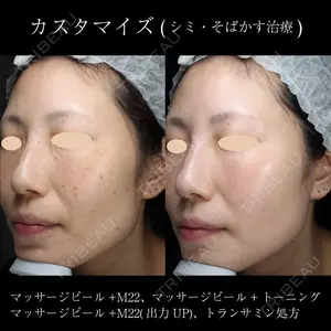 麹町皮ふ科・形成外科クリニック 安藤 玲奈医師の症例
