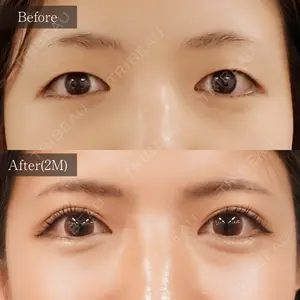麹町皮ふ科・形成外科クリニック 安藤 玲奈医師の症例