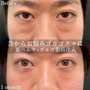 症例