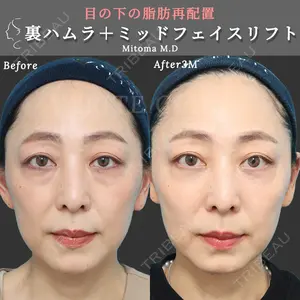 ヴェリテクリニック 銀座院 三苫 葉子医師の症例