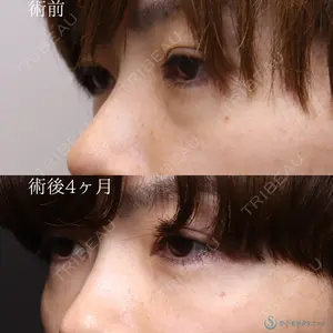 症例