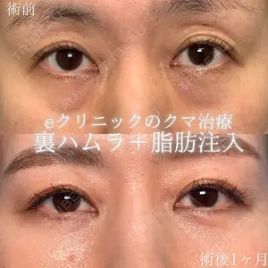eクリニック 大阪梅田 西日本統括院 江﨑 正俊医師の症例