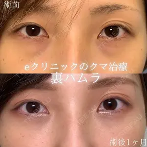 eクリニック 大阪梅田 西日本統括院 江﨑 正俊医師の症例