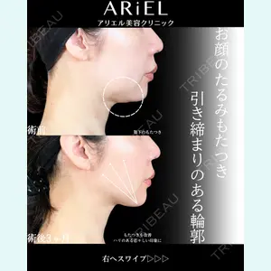 アリエル美容クリニック 大宮院 鈴木　桂介医師の症例