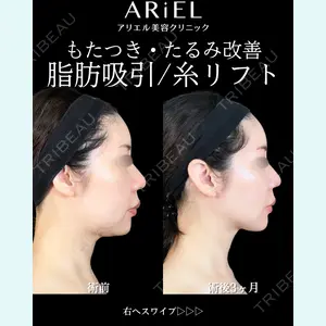 アリエル美容クリニック 大宮院 鈴木　桂介医師の症例