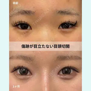 症例
