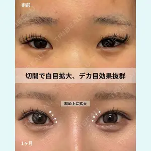 症例
