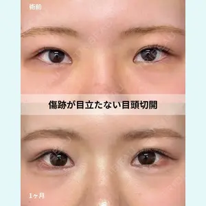 症例