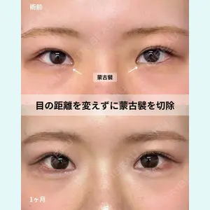 症例