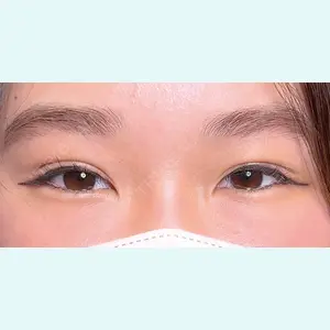 Shion Beauty Clinic 橋本 詩音医師の症例