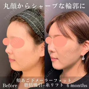 eクリニック 金沢本院の症例