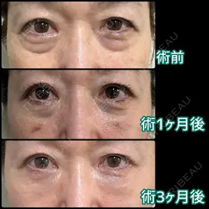 症例
