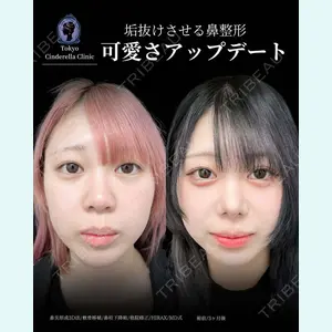 東京シンデレラ美容外科 新宿院 吉原 伯医師の症例
