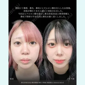 東京シンデレラ美容外科 新宿院 吉原 伯医師の症例