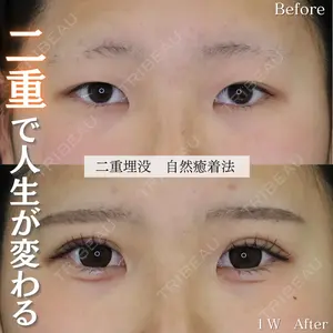 症例