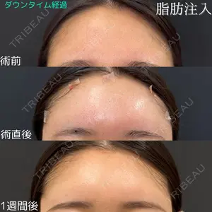 ルラ美容クリニック 仙台院の症例