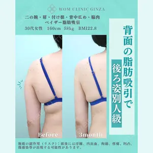 WOM CLINIC GINZA （ワム クリニック ギンザ） 佐々木 和司医師の症例