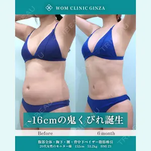WOM CLINIC GINZA （ワム クリニック ギンザ） 佐々木 和司医師の症例