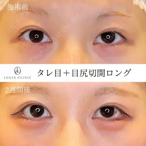 LOUIS CLINIC 二子玉川院【ルイクリニック】 小松 塁医師の症例