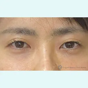 Original Beauty Clinic GINZA 佐藤玲史医師の症例