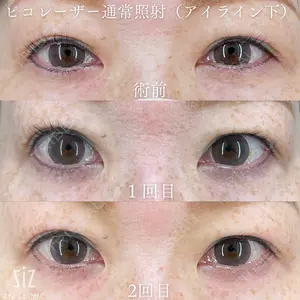 ziz CLINIC 村岡 史子医師の症例