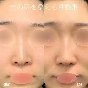症例