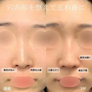 症例
