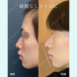 症例