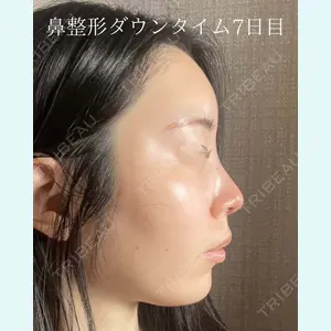症例