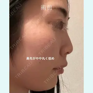 症例