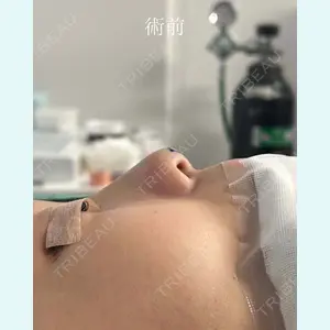 症例