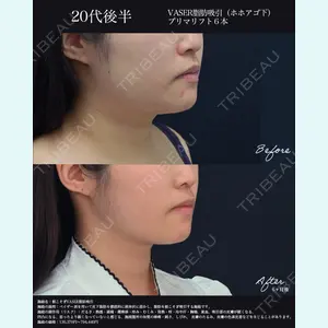 湘南美容クリニック 名古屋院 山本 高士医師の症例