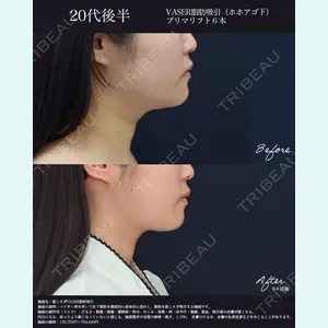湘南美容クリニック 名古屋院 山本 高士医師の症例