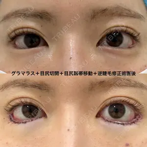 エターナル美容クリニックの症例