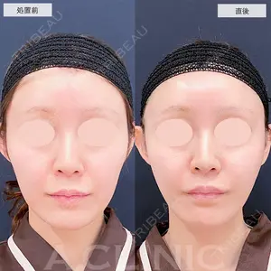 A CLINIC（エークリニック） 仙台院 伊藤 瑠桂医師の症例