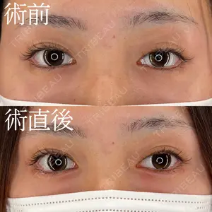 HAAB×DREAM BEAUTY CLINIC 大阪梅田院 柏木 太雅医師の症例