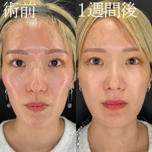 HAAB×DREAM BEAUTY CLINIC 大阪梅田院 柏木 太雅医師の症例